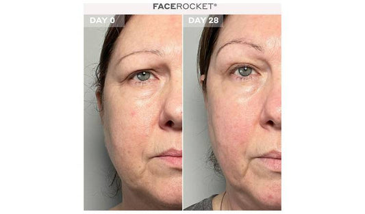 MAGNITON FaceFocket 5-in-1 Facial Handheld Massager