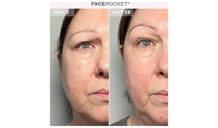 MAGNITON FaceFocket 5-in-1 Facial Handheld Massager