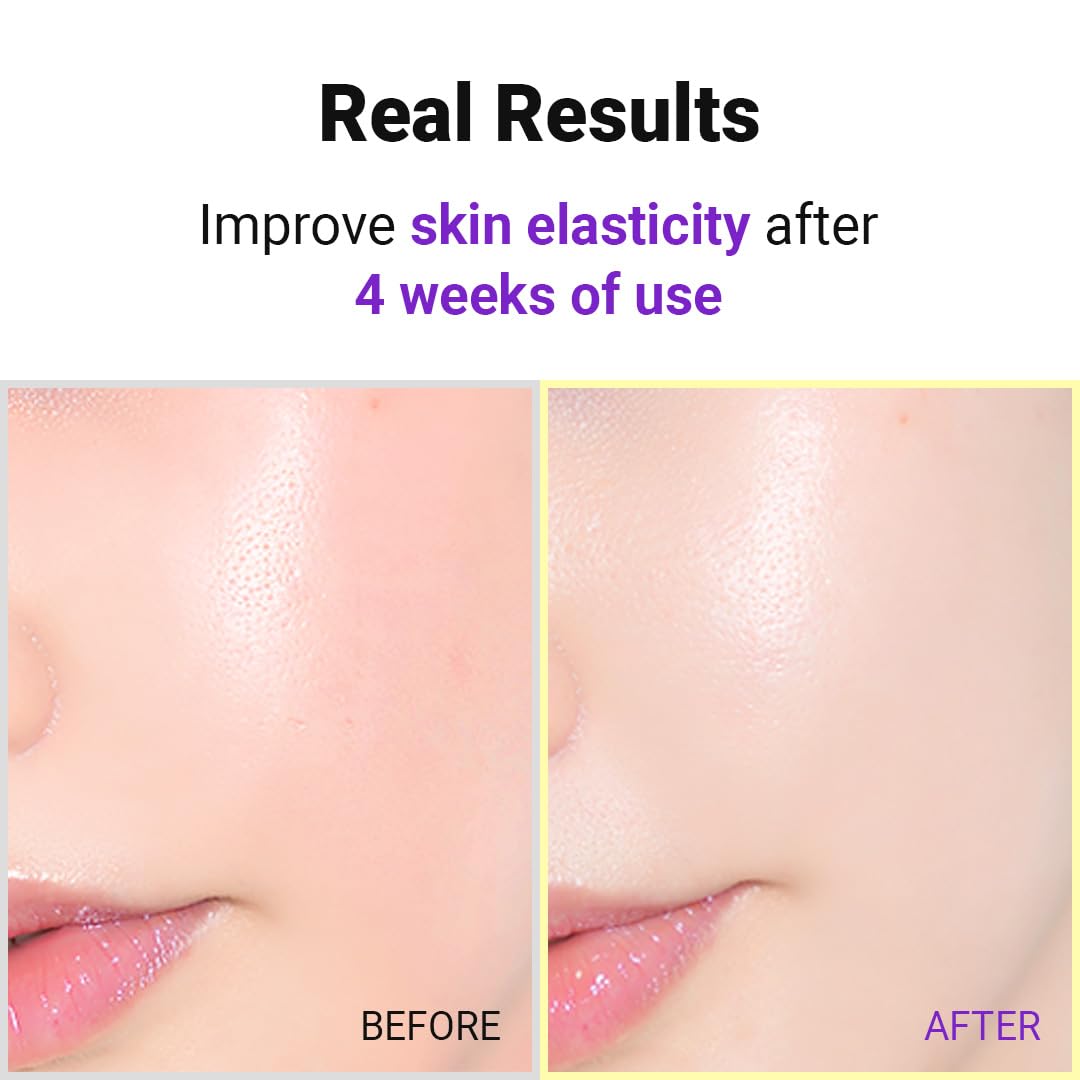 ISNTREE Hyper Retinol EX 1.0 Serum