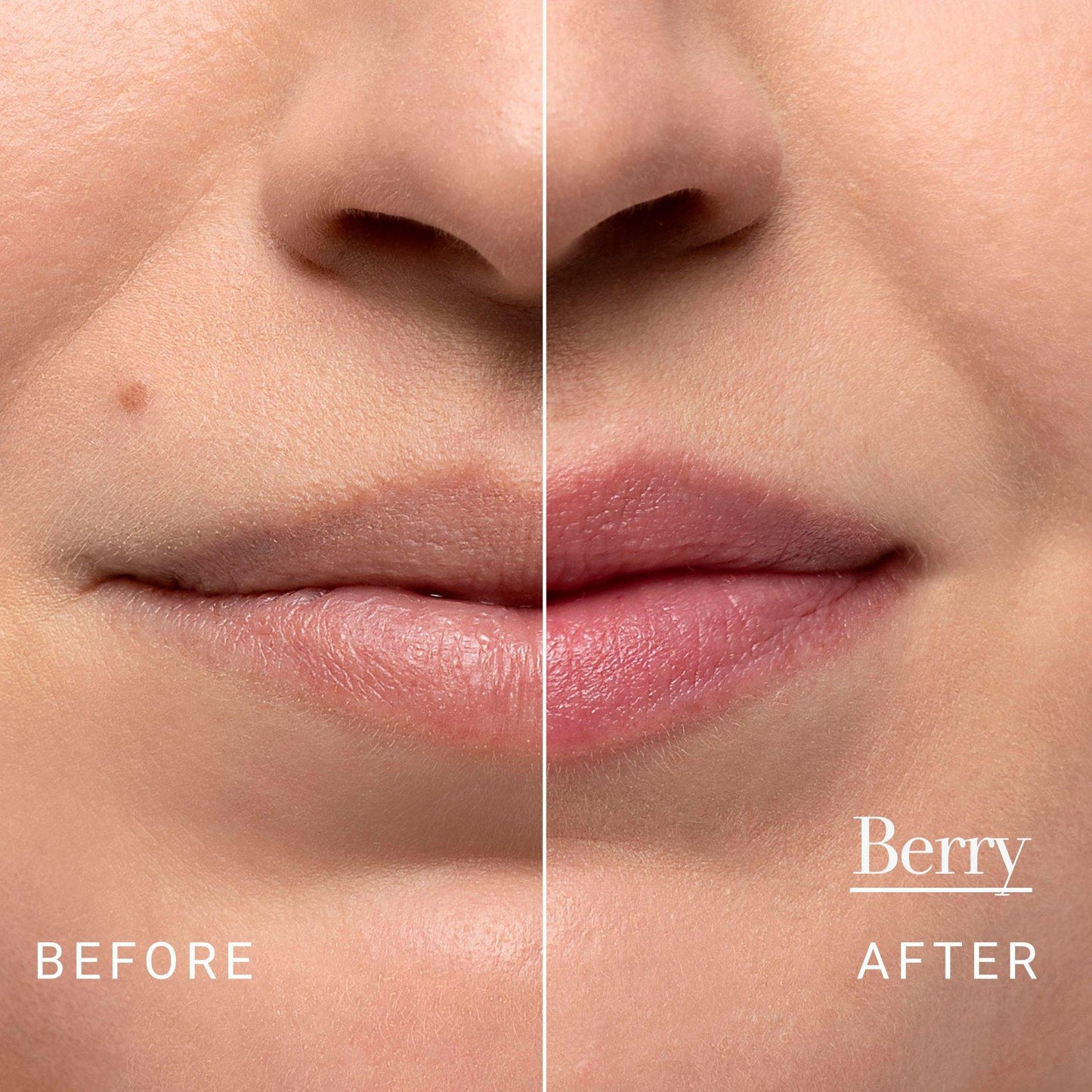 FRESH Fresh Sugar Lip Treatment