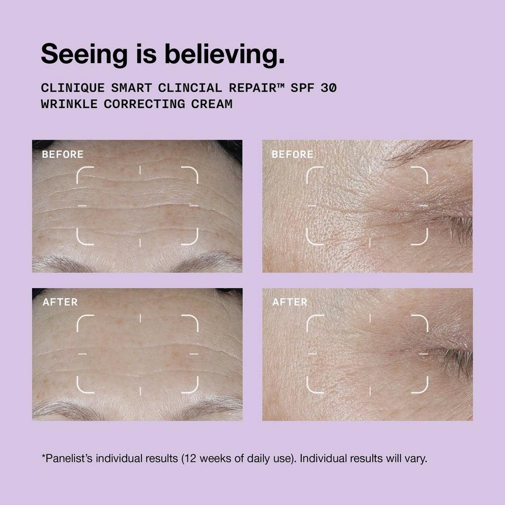 Clinique Smart Clinical Repair™ SPF 30 Wrinkle Correcting Cream 50ml