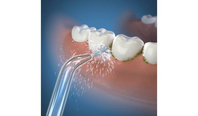 Waterpik Replacement Classic Jet Tip Attachment